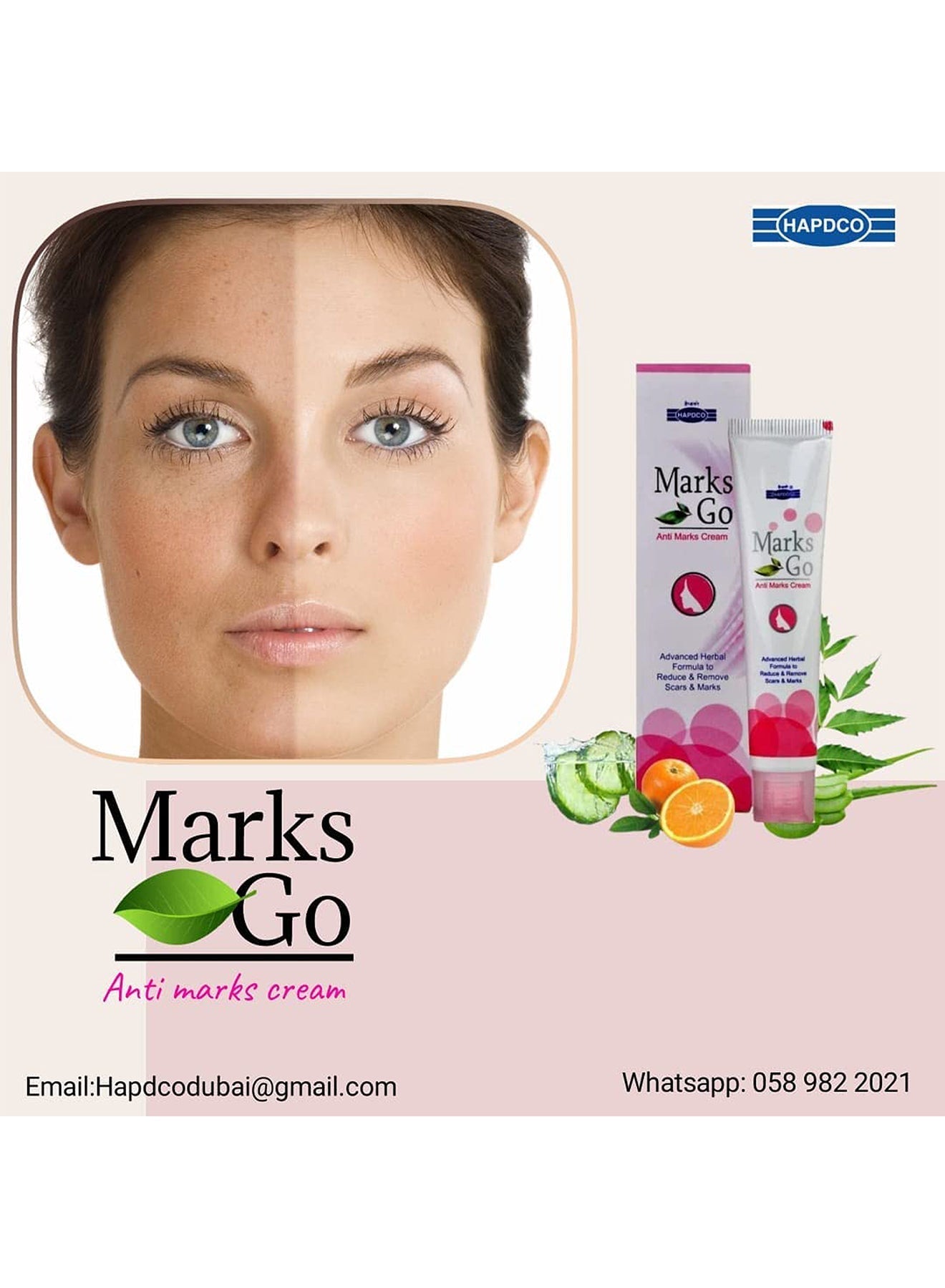 Anti Marks Cream Advanced Herbal Formula To Reduce And Remove Scar  Marks 25g Value Pack of 4 