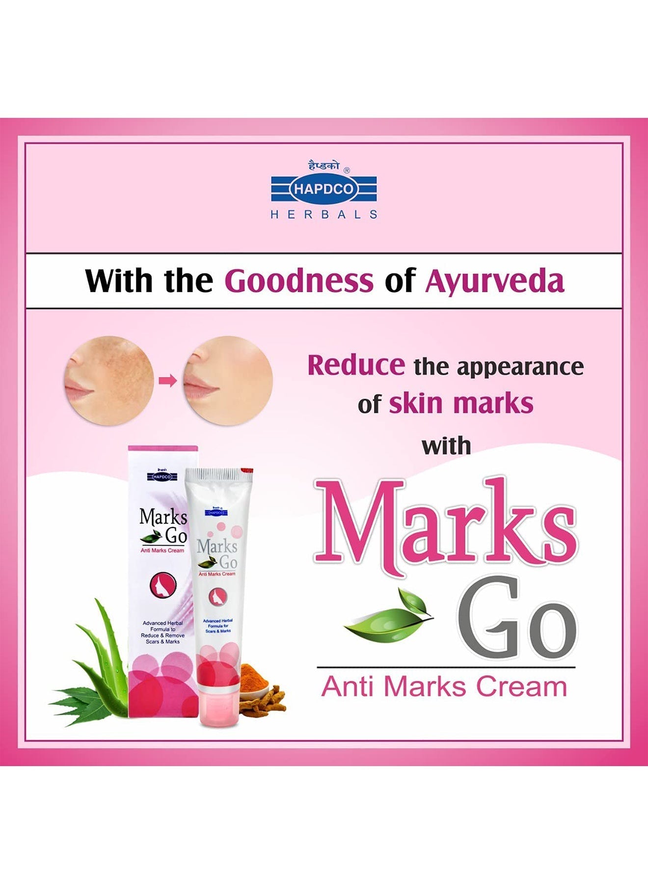 Anti Marks Cream Advanced Herbal Formula To Reduce And Remove Scar  Marks 25g Value Pack of 3 