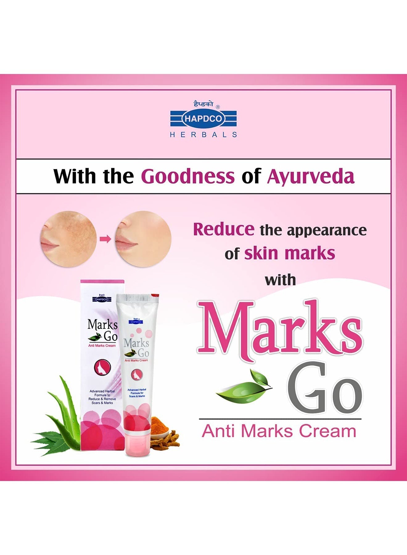 Anti Marks Cream Advanced Herbal Formula To Reduce And Remove Scar  Marks 25g Value Pack of 2 