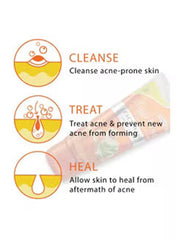 Ayurvedic Cream Acne and Pimples Cream Remover Black Head Skin Treatment 25 gm